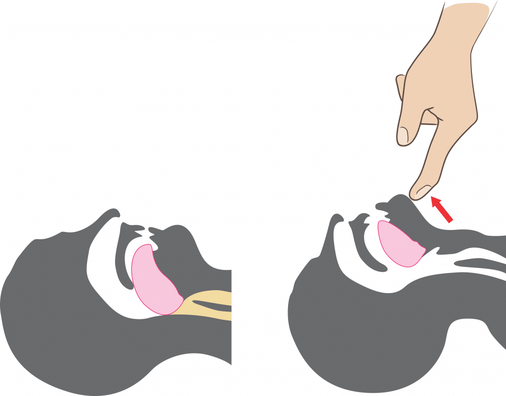Approach to the seriously unwell child TeachMePaediatrics