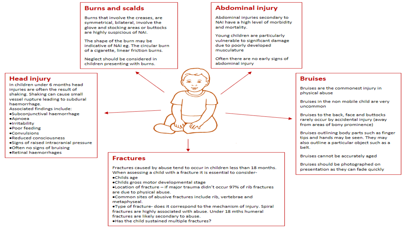 Child Protection - TeachMePaediatrics - Emotional - Physical - Sexual