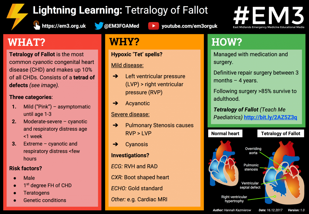 Tetralogy Of Fallot Pathophysiology Managment Teachmepaediatrics