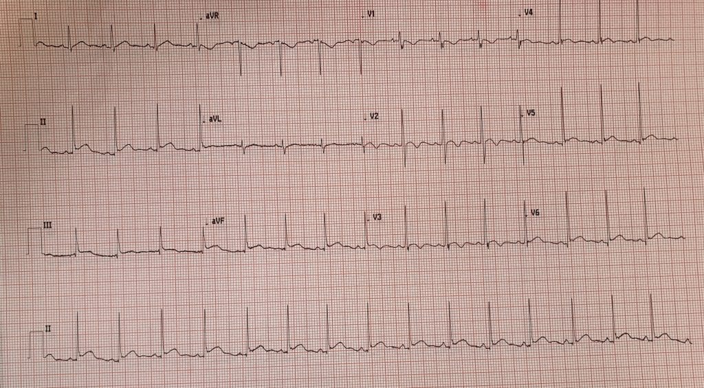 Diabetic Ketoacidosis - Management - TeachMePaediatrics