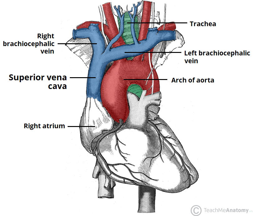 Image showing the heart with the main vessels including the superior vena cava entering the right atrium. The arch of aorta, right and left brachiocephalic veins are also shown